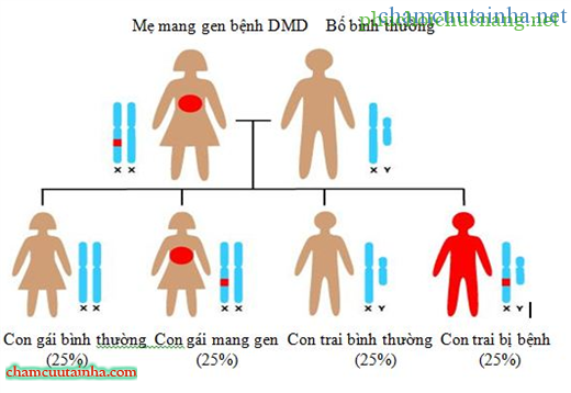 Hemophilia