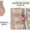 Chữa đau thần kinh tọa thế nào?
