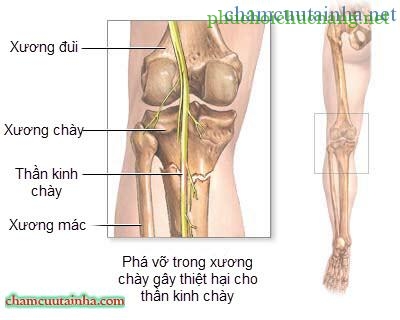 day-than-kinh-chay