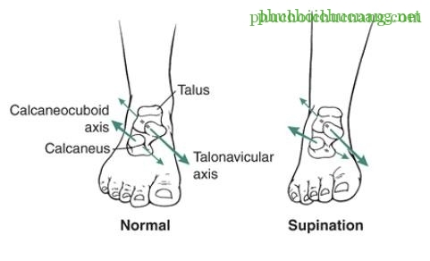 The Ankle and Foot_page13_image14