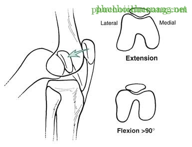 Khớp gối_page10_image9