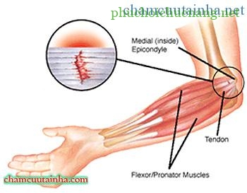 golf_elbow_visual