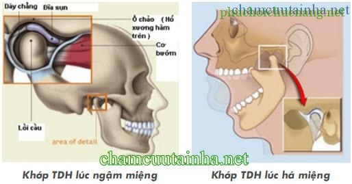 khop-thai-duong-ham