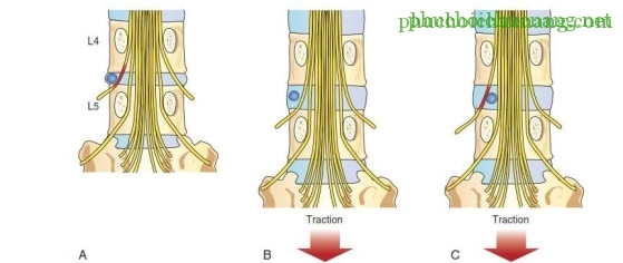 Traction_page8_image3