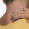 Phục hồi chức năng thoát vị đĩa đệm cột sống cổ