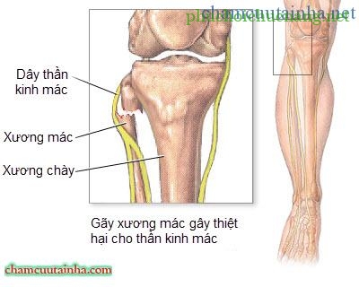 roi-loan-chuc-nang-day-than-kinh-mac-nong