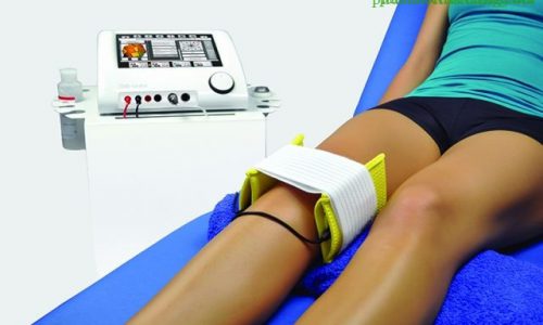 Các loại điện xung trị liệu