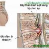 Phục hồi chức năng thoát vị đĩa đệm cột sống thắt lưng
