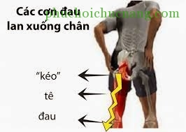 Phục hồi chức năng thoát vị đĩa đệm cột sống thắt lưng